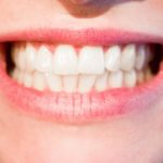 Obecna technologia wykorzystywana w salonach stomatologii estetycznej może spowodować, że odbierzemy śliczny uśmiech.