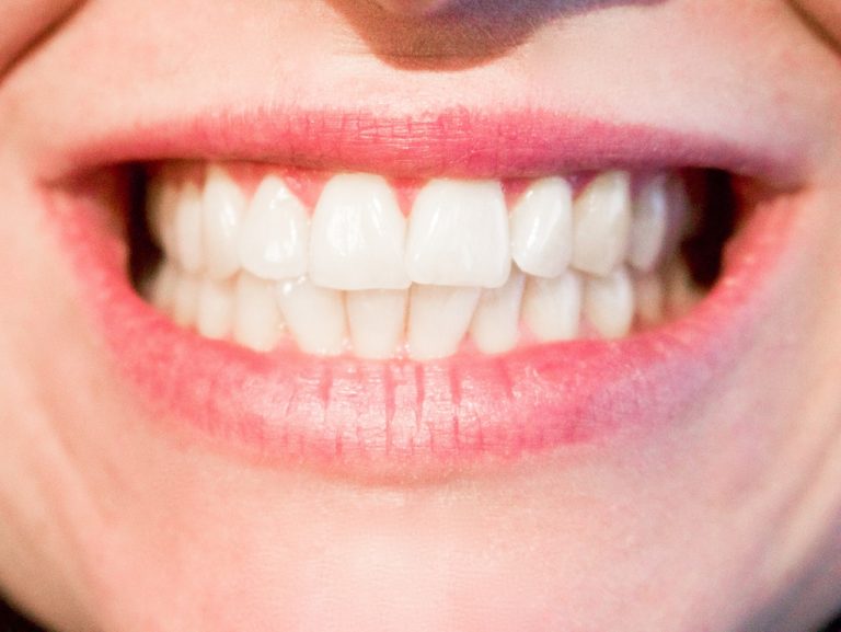 Obecna technologia wykorzystywana w salonach stomatologii estetycznej może spowodować, że odbierzemy śliczny uśmiech.